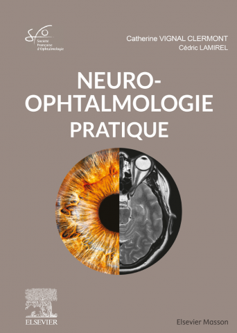 Rapport SFO, Neuro-ophtalmologie pratique de Catherine Vignal